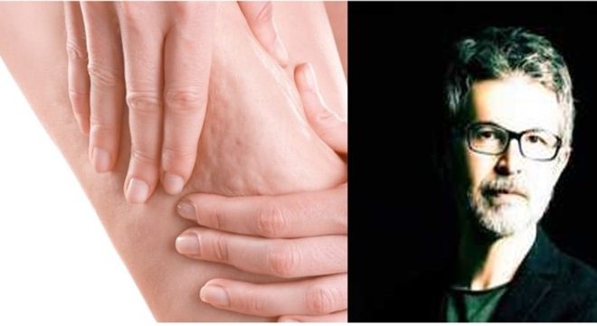 PROF. DR. AHMET KARACALAR: “SELÜLİT SADECE SELÜLİT DEĞİLDİR; METABOLİK BİR AYNADIR”